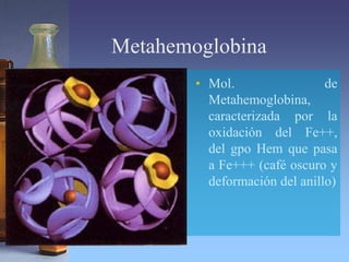 Metahemoglobina
• Mol. de
Metahemoglobina,
caracterizada por la
oxidación del Fe++,
del gpo Hem que pasa
a Fe+++ (café oscuro y
deformación del anillo)
 