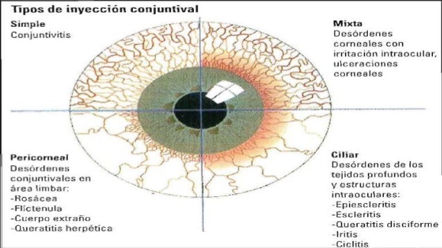 Anestesicos Locales Anestesicos Locales