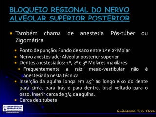    Também chama           de   anestesia    Pós-túber     ou
    Zigomática
     Ponto de punção: Fundo de saco entre 1º e 2º Molar
     Nervo anestesiado: Alveolar posterior superior
     Dentes anestesiados: 1º, 2º e 3º Molares maxilares
      Frequentemente        a raiz mesio-vestibular não é
        anestesiada nesta técnica
     Inserção da agulha longa em 45° ao longo eixo do dente
      para cima, para trás e para dentro, bisel voltado para o
      osso. Inserir cerca de 3/4 da agulha.
     Cerca de 1 tubete
 