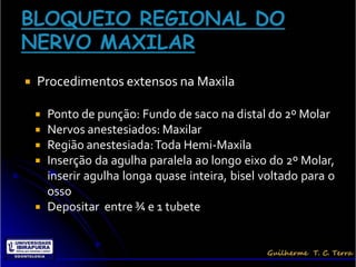    Procedimentos extensos na Maxila

     Ponto de punção: Fundo de saco na distal do 2º Molar
     Nervos anestesiados: Maxilar
     Região anestesiada: Toda Hemi-Maxila
     Inserção da agulha paralela ao longo eixo do 2º Molar,
      inserir agulha longa quase inteira, bisel voltado para o
      osso
     Depositar entre ¾ e 1 tubete
 
