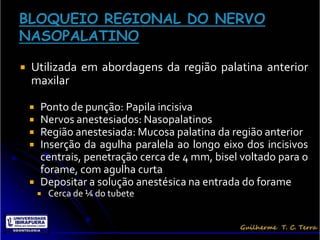    Utilizada em abordagens da região palatina anterior
    maxilar

       Ponto de punção: Papila incisiva
       Nervos anestesiados: Nasopalatinos
       Região anestesiada: Mucosa palatina da região anterior
       Inserção da agulha paralela ao longo eixo dos incisivos
        centrais, penetração cerca de 4 mm, bisel voltado para o
        forame, com agulha curta
       Depositar a solução anestésica na entrada do forame
           Cerca de ¼ do tubete
 