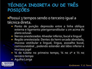 Possui 3 tempos sendo o terceiro igual a
técnica direta.
   Ponto de punção: depressão entre a linha oblíqua
    externa e ligamento pterigomandibular 1 cm acima do
    plano oclusal.
   Nervos anestesiados: Alveolar inferior, bucal e lingual
   Região anestesiada: Dentes da hemi-arcada abordada,
    mucosa vestibular e lingual, língua, assoalho bucal,
    comissuralabial , podendo estender até lábio inferior e
    mucosa jugal
   ¼ de tubete no primeiro tempo, ¼ no 2º e ½ no
    terceiro tempo
   Agulha Longa
 