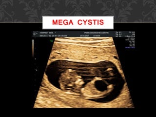 MEGA CYSTIS
 