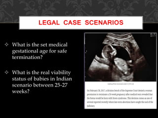  What is the set medical
gestational age for safe
termination?
 What is the real viability
status of babies in Indian
scenario between 25-27
weeks?
LEGAL CASE SCENARIOS
 