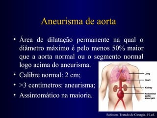 Aneurisma | PPT