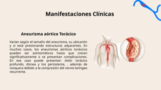 ANEURISMA definicion, su clasificacion etc.pptx