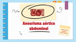 Aneurisma aórtico
abdominal
 