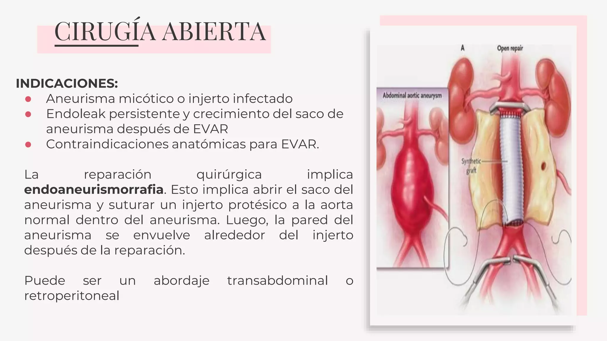 Aneurisma de la aorta abdominal | PPTX