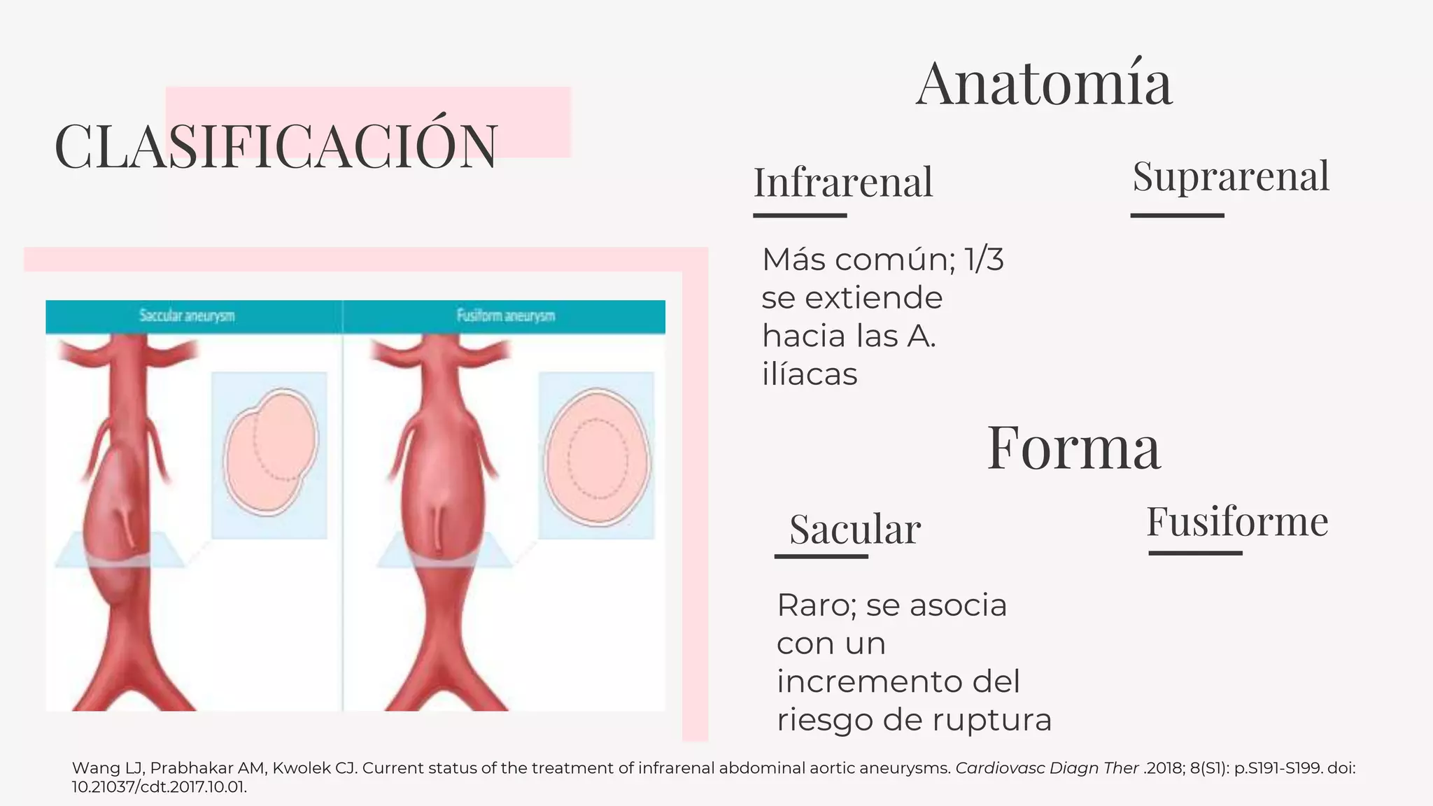 Aneurisma de la aorta abdominal | PPTX