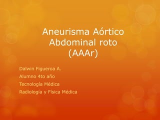 Aneurisma Aórtico
Abdominal roto
(AAAr)
Dalwin Figueroa A.
Alumno 4to año
Tecnología Médica
Radiología y Física Médica
 