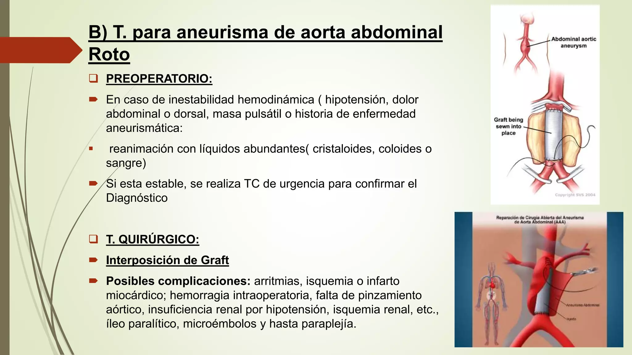 Aneurisma aortico abdominal | PPTX
