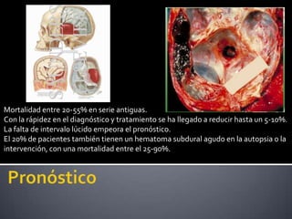 Mortalidad entre 20-55% en serie antiguas.
Con la rápidez en el diagnóstico y tratamiento se ha llegado a reducir hasta un 5-10%.
La falta de intervalo lúcido empeora el pronóstico.
El 20% de pacientes también tienen un hematoma subdural agudo en la autopsia o la
intervención, con una mortalidad entre el 25-90%.
 