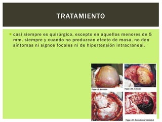 TRATAMIENTO

 casi siempre es quirúrgico, excepto en aquellos menores de 5
  mm. siempre y cuando no produzcan efecto de masa, no den
  síntomas ni signos focales ni de hipertensión intracraneal.
 