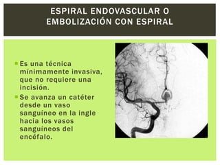 ESPIRAL ENDOVASCULAR O
        EMBOLIZACIÓN CON ESPIRAL



 Es una técnica
  mínimamente invasiva,
  que no requiere una
  incisión.
 Se avanza un catéter
  desde un vaso
  sanguíneo en la ingle
  hacia los vasos
  sanguíneos del
  encéfalo.
 