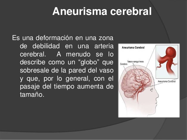 El dolor en los pechos da a la izquierda en la espalda