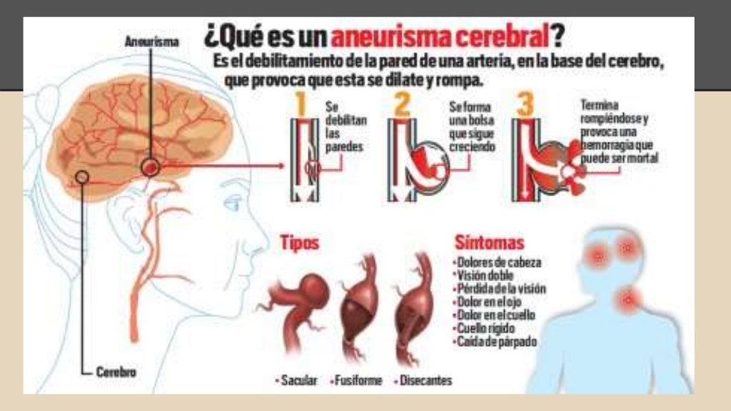 Que es el peristaltismo