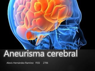 Aneurisma cerebral
Alexis Hernández Ramírez FESI 2706
 