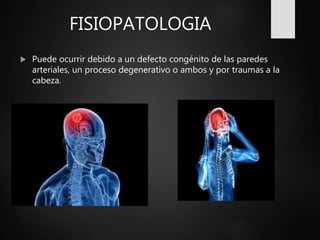 FISIOPATOLOGIA
 Puede ocurrir debido a un defecto congénito de las paredes
arteriales, un proceso degenerativo o ambos y por traumas a la
cabeza.
 