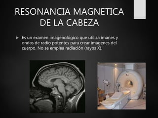 RESONANCIA MAGNETICA
DE LA CABEZA
 Es un examen imagenológico que utiliza imanes y
ondas de radio potentes para crear imágenes del
cuerpo. No se emplea radiación (rayos X).
 