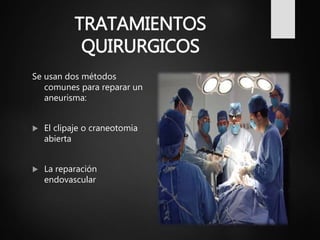 TRATAMIENTOS
QUIRURGICOS
Se usan dos métodos
comunes para reparar un
aneurisma:
 El clipaje o craneotomia
abierta
 La reparación
endovascular
 