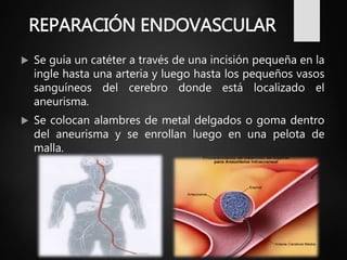 REPARACIÓN ENDOVASCULAR
 Se guía un catéter a través de una incisión pequeña en la
ingle hasta una arteria y luego hasta los pequeños vasos
sanguíneos del cerebro donde está localizado el
aneurisma.
 Se colocan alambres de metal delgados o goma dentro
del aneurisma y se enrollan luego en una pelota de
malla.
 