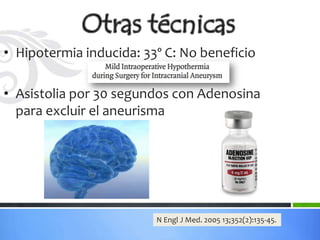 • Hipotermia inducida: 33º C: No beneficio

• Asistolia por 30 segundos con Adenosina
  para excluir el aneurisma




                         N Engl J Med. 2005 13;352(2):135-45.
 