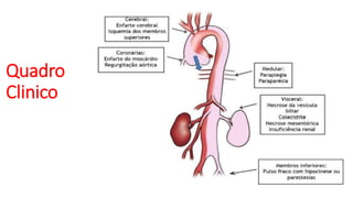 Quadro
Clinico
 