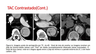 TAC Contrastado(Cont.)
 
