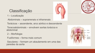 Classificação
1 – Localização
Abdominais – suprarrenais e infrarrenais
Torácicos – ascendente, arco aórtico e descendente
Toracoabdominais – envolvem aortas torácica e
abdominal
2 – Morfologia
Fusiformes – forma mais comum
Saculares – formam um abaulamento em uma das
paredes da aorta
 
