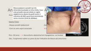 Aneurisma de Aorta Abnominais (AAAs)
Assintomáticos e descobertos durante exame de imagem por outra indicação
Exame Físico:
-Massa pulsátil abdominal -Dolorosa ou indolor
-Com ou sem sopro associado √ Sinal de DeBakey
Pcts <50 anos desconforto abdominal em hipogástrico ou lombar
Obs.: Surgimento súbito ou piora da dor indicativo de Rotura de aneurisma
Massa palpável e pulsátil nas três
dimensões localizada na linha média. Caso
esta pulsação seja percebida na região
epigástrica ou abaixo do gradil costal, é
indicativo de AAA suprarrenal acometendo
ramos viscerais (Sinal de deBakey)
 