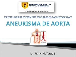 Comprehensive Overview of Aortic Aneurysm and Dissection: Anatomy ...