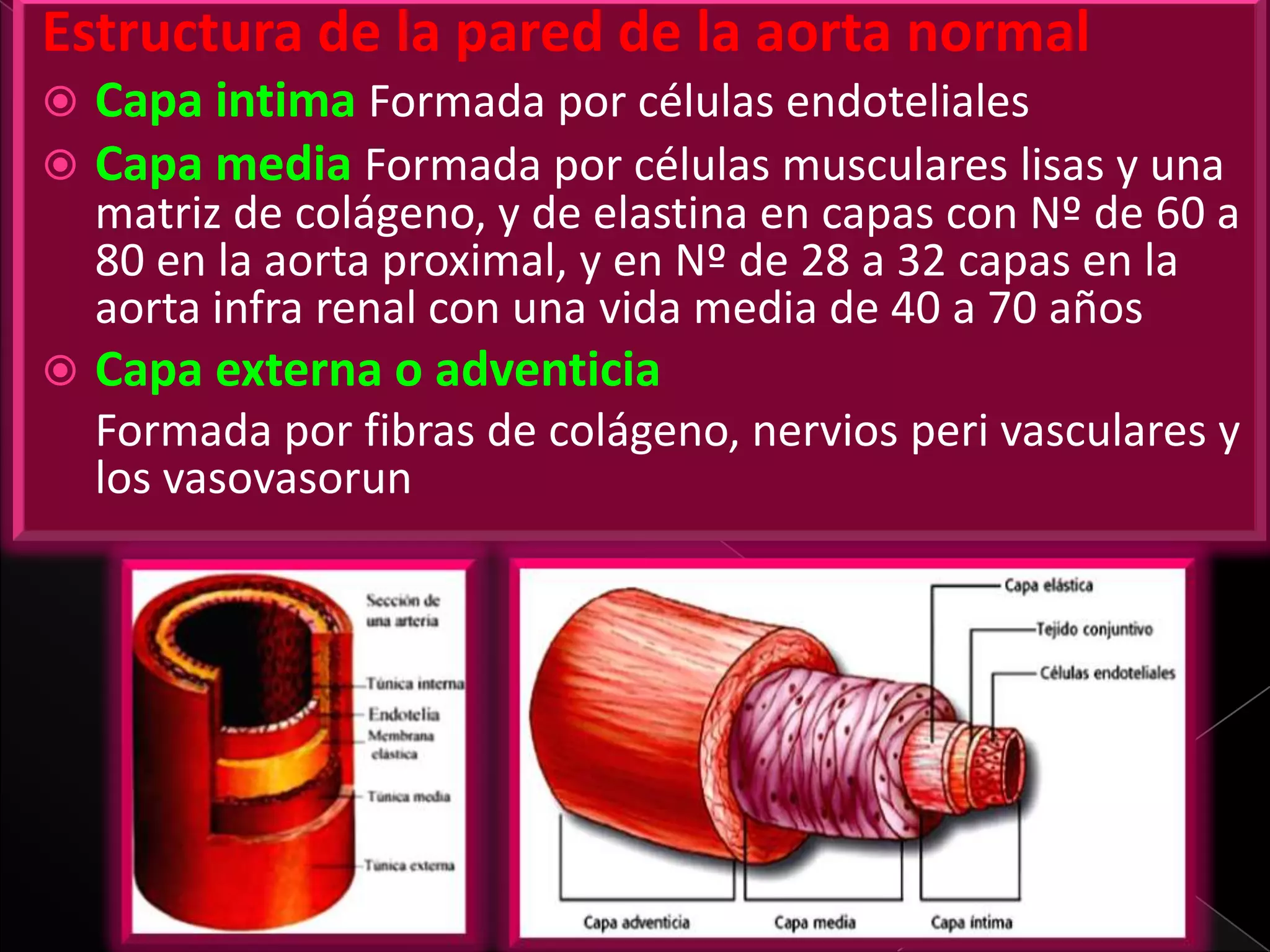 Aneurisma de aorta abdominal | PPTX