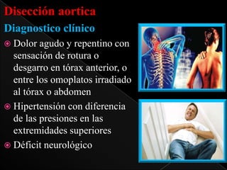 Disección aortica
Diagnostico clínico
 Dolor

agudo y repentino con
sensación de rotura o
desgarro en tórax anterior, o
entre los omoplatos irradiado
al tórax o abdomen
 Hipertensión con diferencia
de las presiones en las
extremidades superiores
 Déficit neurológico

 