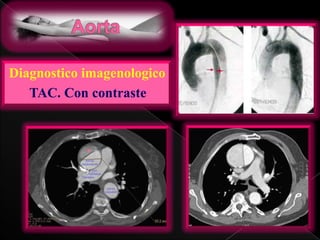 Diagnostico imagenologico
TAC. Con contraste

 