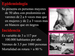 Epidemiología
Se presenta en personas mayores
de 50 años con predominio en
varones de 2 a 6 veces mas que
en mujeres y de 2 a 3 veces mas
en blancos que en negros

Incidencia
Es variable de 3 a 117 por
100.000 habitantes por año
Varones de 3.5 por 1000 personas
Mortalidad en rotura > a 80 %

 