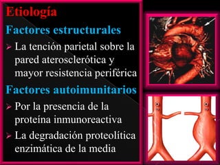 Etiología
Factores estructurales
 La

tención parietal sobre la
pared aterosclerótica y
mayor resistencia periférica

Factores autoimunitarios
 Por

la presencia de la
proteína inmunoreactiva
 La degradación proteolítica
enzimática de la media

 