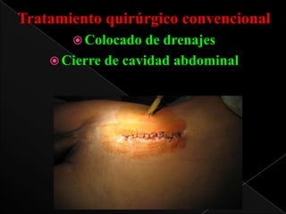 Tratamiento quirúrgico convencional
 Colocado

de drenajes
 Cierre de cavidad abdominal

 