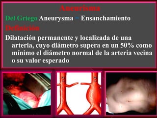 Aneurisma
Del Griego Aneurysma = Ensanchamiento

Definición
Dilatación permanente y localizada de una
arteria, cuyo diámetro supera en un 50% como
mínimo el diámetro normal de la arteria vecina
o su valor esperado

 