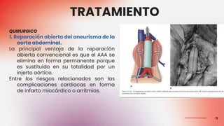 ANEURISMA DE AORTA ABDOMINAL.pptx