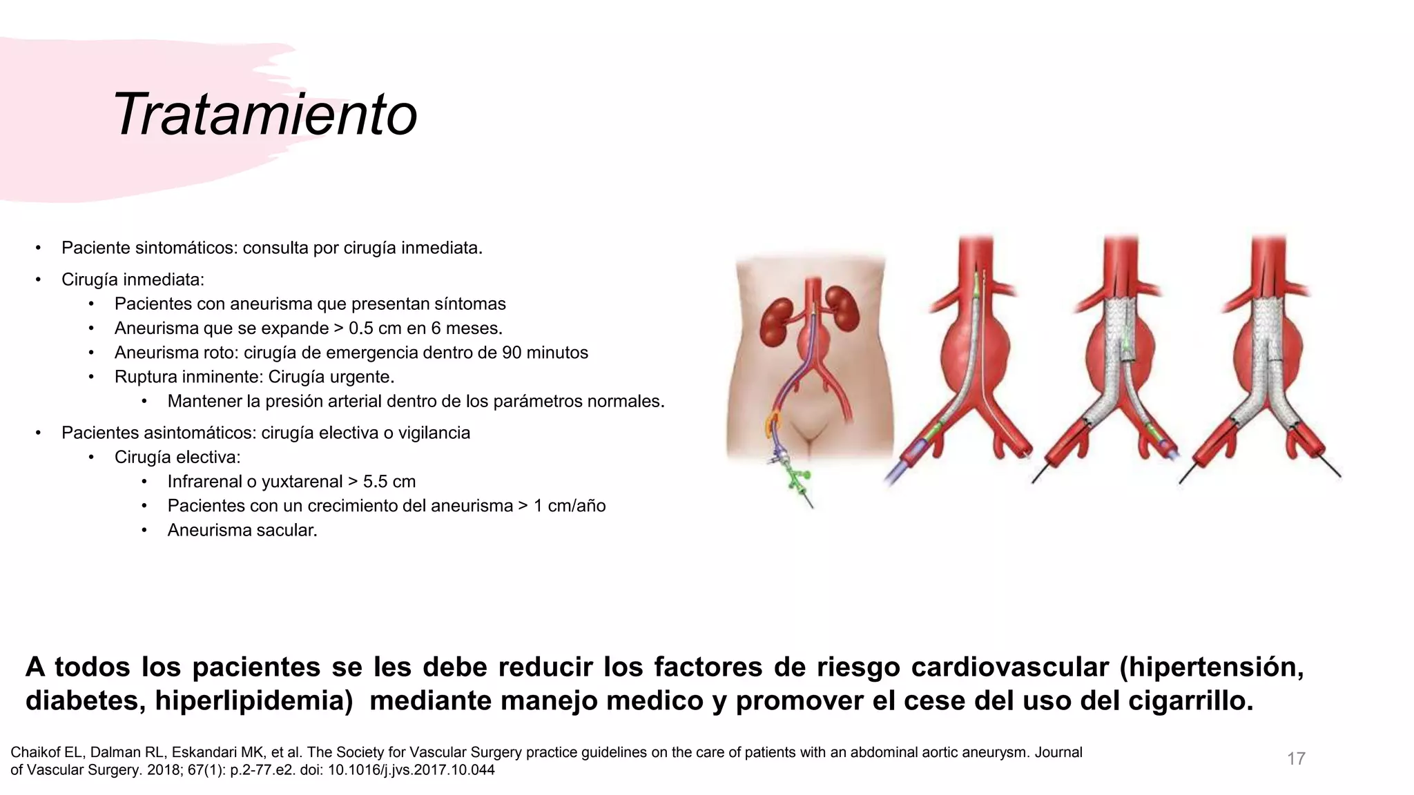 Aneurisma de Aorta Abdominal Alexander Lara | PPTX
