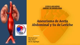 Aneurisma de Aorta
Abdominal y Sx de Leriche
CCRCO ASCARDIO
UNIDAD DE ANGIOLOGIA
Realizado por:
Elias Parra
R2 de Angiología
 