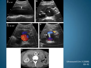 Ultrasound Crin 3 (2008)83–91