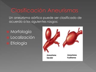  Morfología
 Localización
 Etiología
Un aneurisma aórtico puede ser clasificado de
acuerdo a los siguientes rasgos:
 