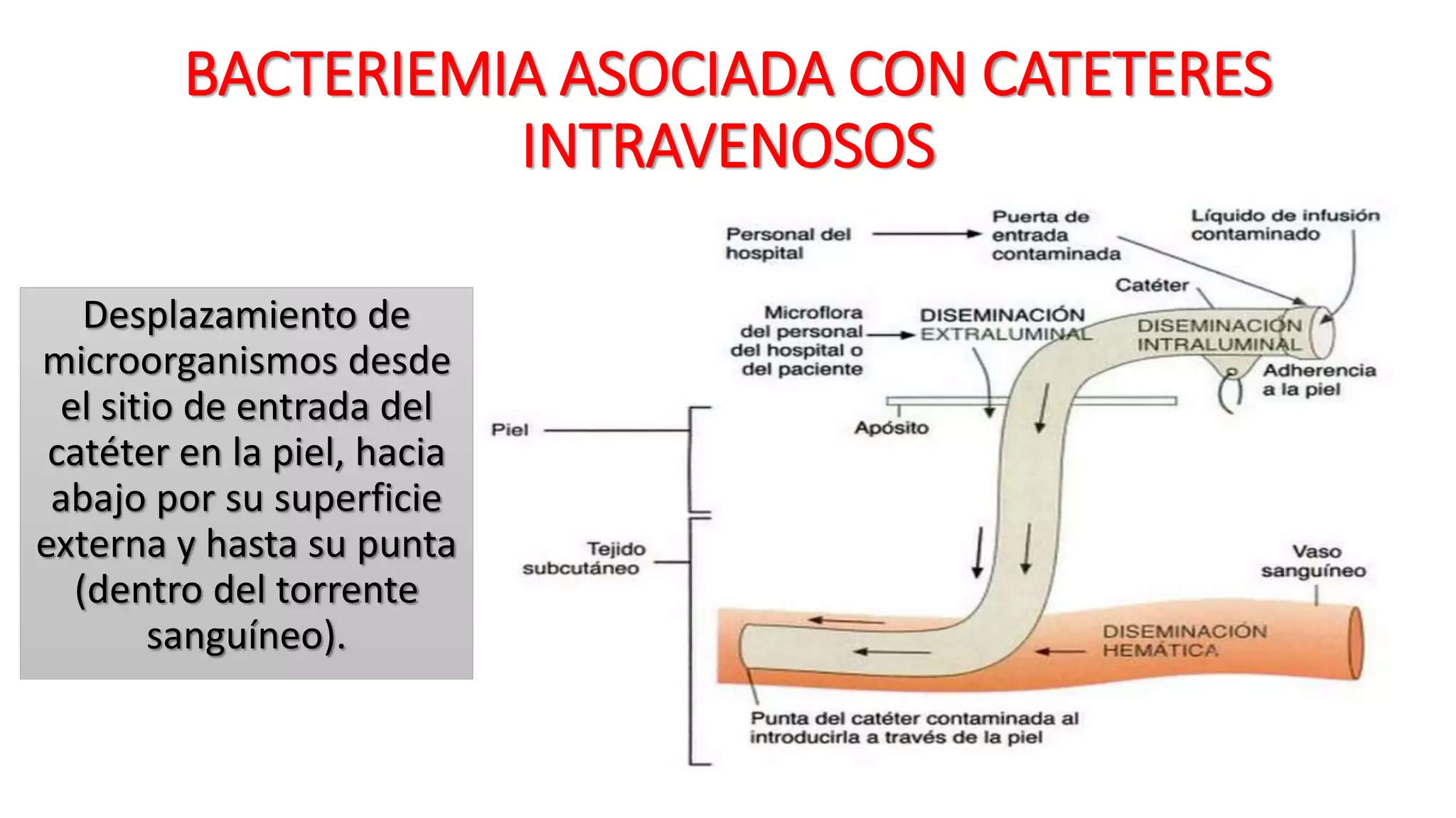 Aneurisma micotico 1 | PPT