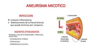 Aneurisma micotico 1 | PPTX