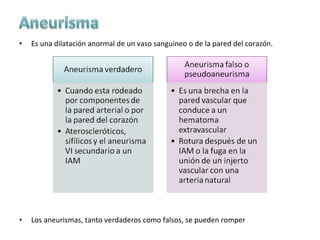 Aneurismas | PPT