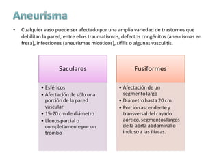 Aneurismas | PPT