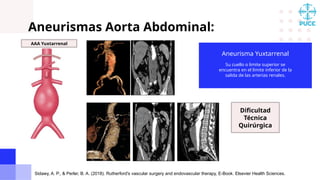 Aneurismas Aorta Abdominal infrarrenal caracteristicas | PPTX