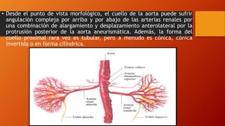 Aneurismas de aorta abdominal | PPTX
