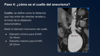 Eva R 28 Guía Completa: 7 Pasos para Evaluar un Aneurisma de Aorta con AngioTAC ...